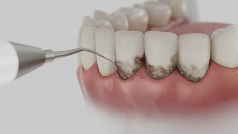 Trusted Teeth Cleaning And Checkup service in Ada, MN - Dentist Open Now